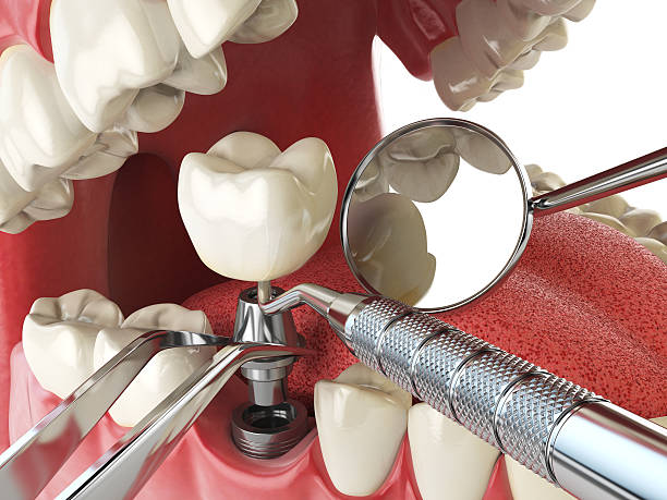 Best Cosmetic Emergency Dentistry in Blue Mound, IL