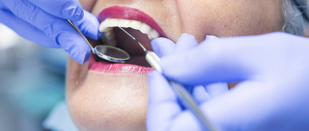 Best Emergency Tooth Extraction in Blue Mound, IL